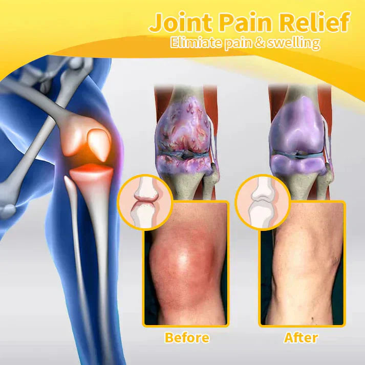 ADNOON™ Magnesium Oil & Bee Venom Joint Healing Spray