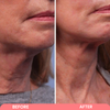 LilyBeth TIghten & Lift Neck Cream